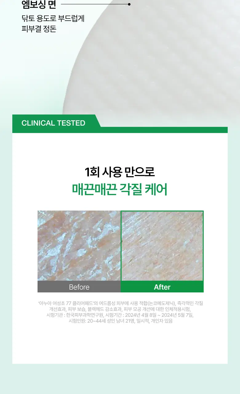 [올영단독] 아누아 패드 리필 기획 3종(어성초/피디알엔/카테킨) 상세페이지 13
